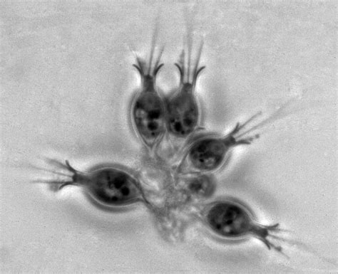  Choanoflagellate: A Tiny Predator With a Whirlwind Appetite That Will Make You Rethink the Meaning of Small!