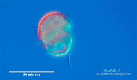  Urocentrum: Can You Believe This Ciliate Swims Using Its Hairy Foot?!